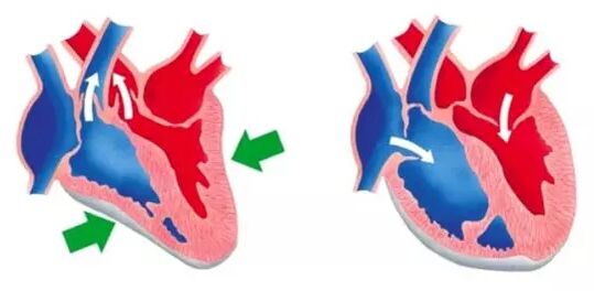 Blutforde normaliza o funcionamento do corazón e dos vasos sanguíneos