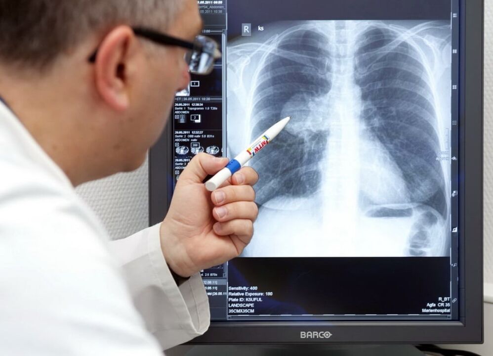 diagnóstico de hipertensión arterial